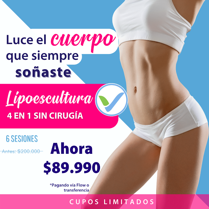 Imagen del Slider