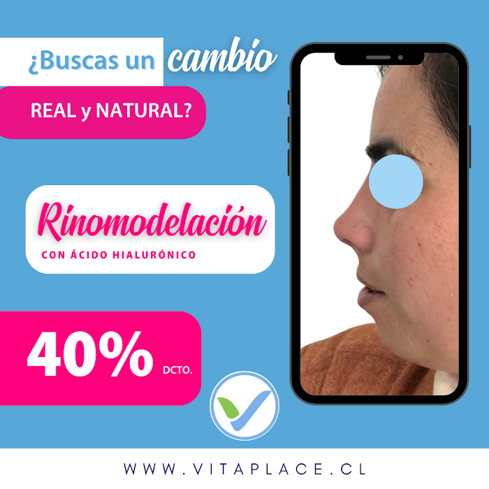 Imagen del Slider