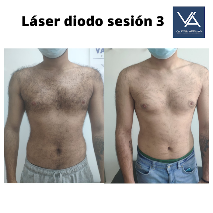 Imagen del Slider