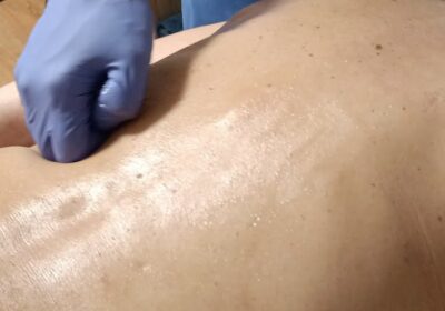 TNDR Vitoria