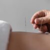 fisioterapia a domicilio | fisionatlloret