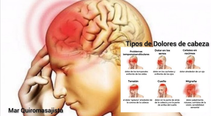 Imagen del Slider