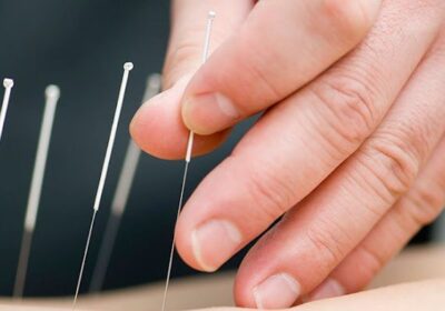 Pinjing – Masaje & Acupuntura