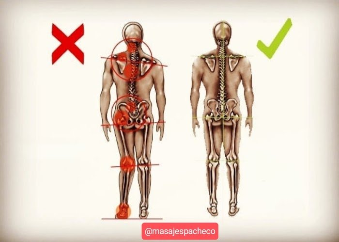 Imagen del Slider