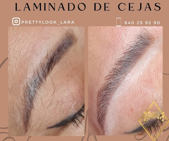Imagen del Slider