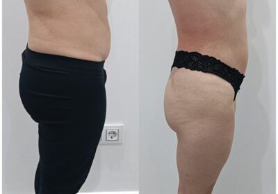 Quiromasajista Ana Rodriguez Espinal