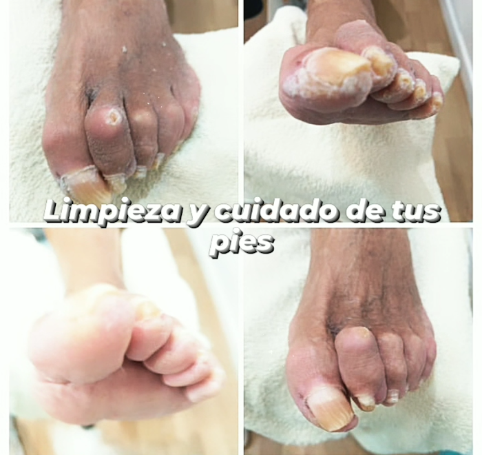 Imagen del Slider