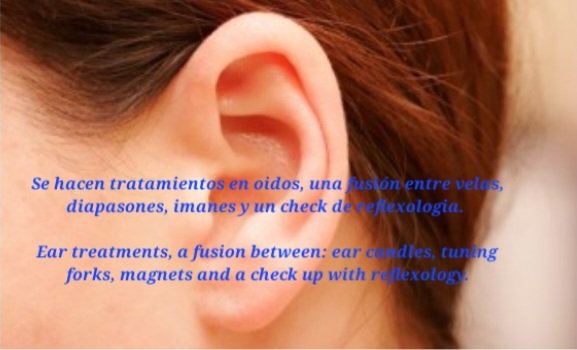 Imagen del Slider