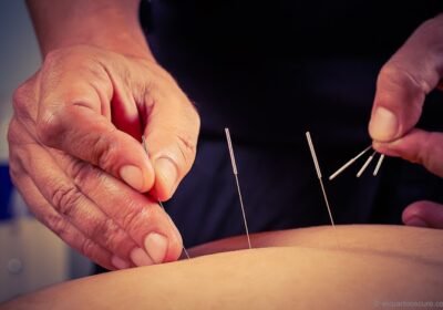 Instituto Yáo Murcia: masajes y medicina tradicional china.