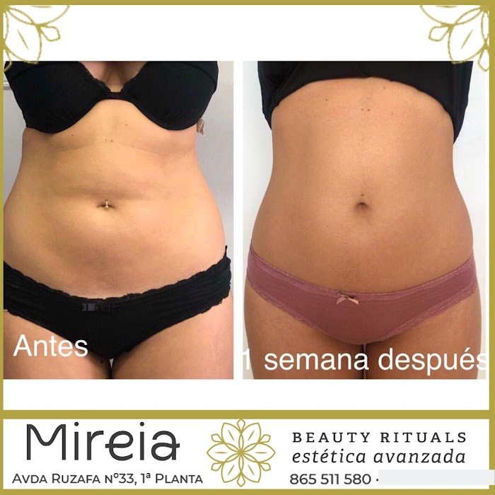 Imagen del Slider