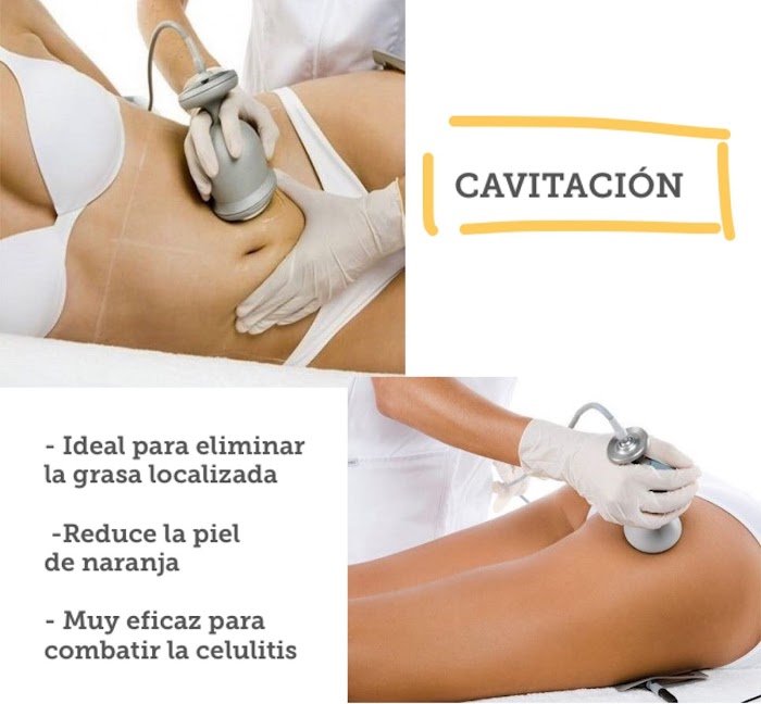 Imagen del Slider