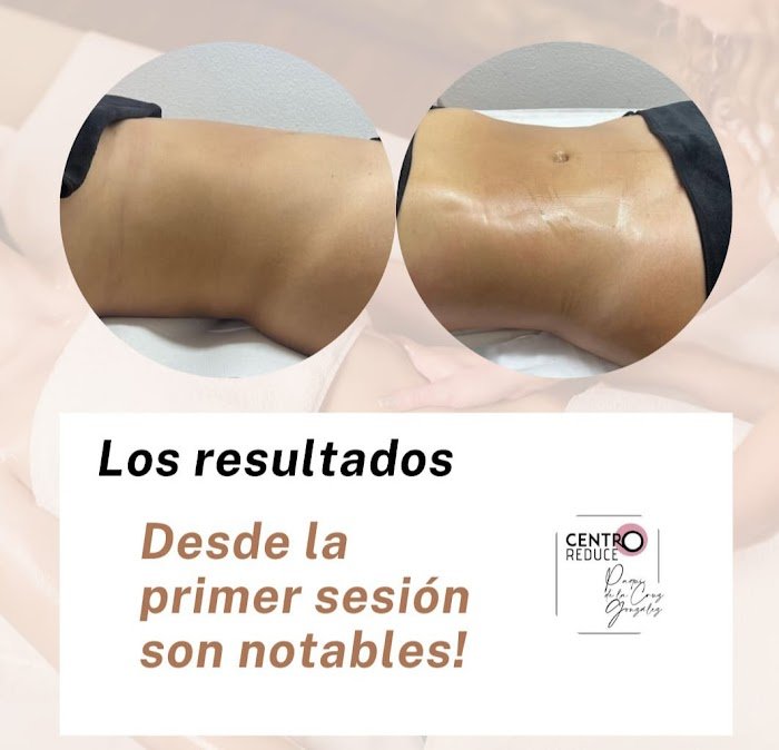 Imagen del Slider