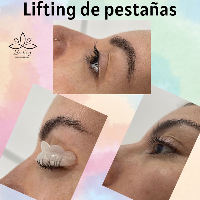Imagen del Slider