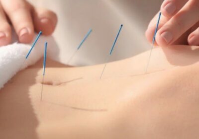 Centro de Terapias Naturales Jesacu