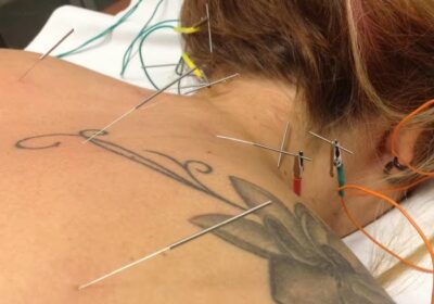 Centro de Acupuntura para personas y animales