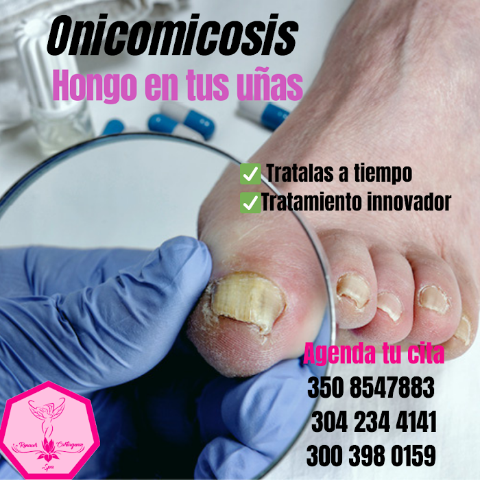 Imagen del Slider