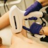 Depilación Laser y Eliminación Tatuajes Estepona - Divinity Beauty Center