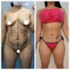 Estética integral CORPO BELLA