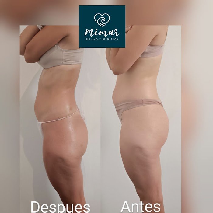 Imagen del Slider