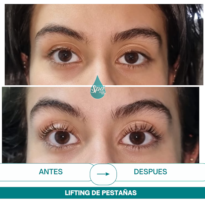 Imagen del Slider