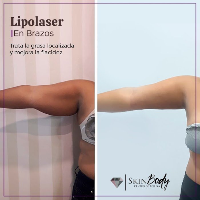 Imagen del Slider