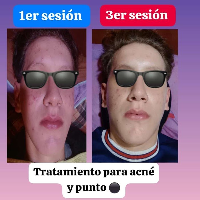Imagen del Slider