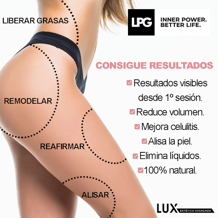 Imagen del Slider