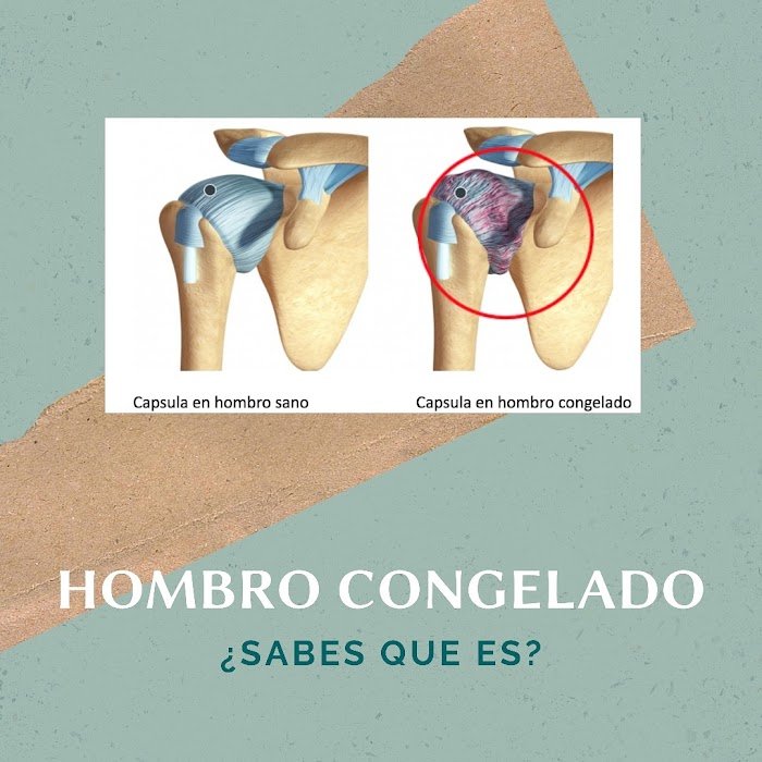 Imagen del Slider