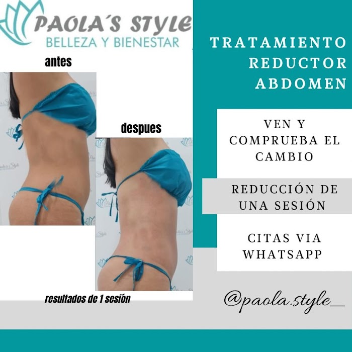 Imagen del Slider