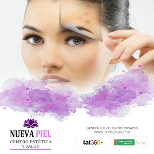 Imagen del Slider
