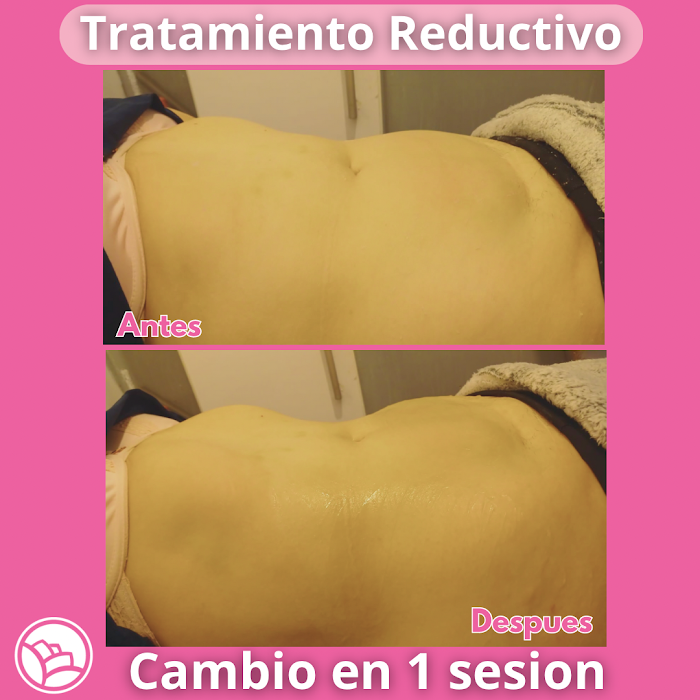 Imagen del Slider