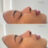 Beaute Cartagena - Medicina Estética