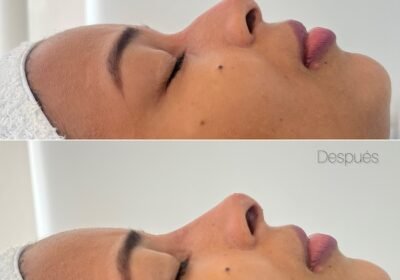 Beaute Cartagena – Medicina Estética