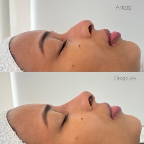 Beaute Cartagena – Medicina Estética