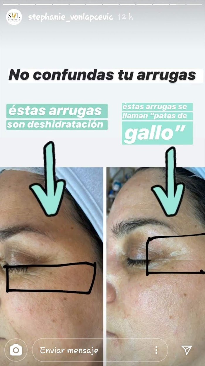 Imagen del Slider
