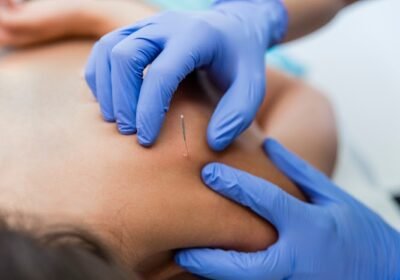 Centro de Fisioterapia Torremolinos
