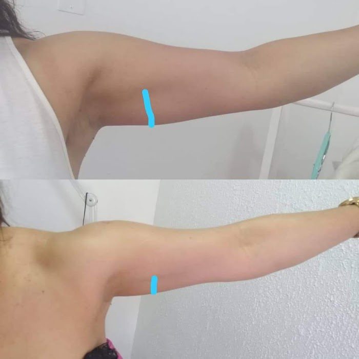 Clinica Reductivos Amapola 100%Holisticos de grado sublime