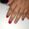 Estetica Fusion