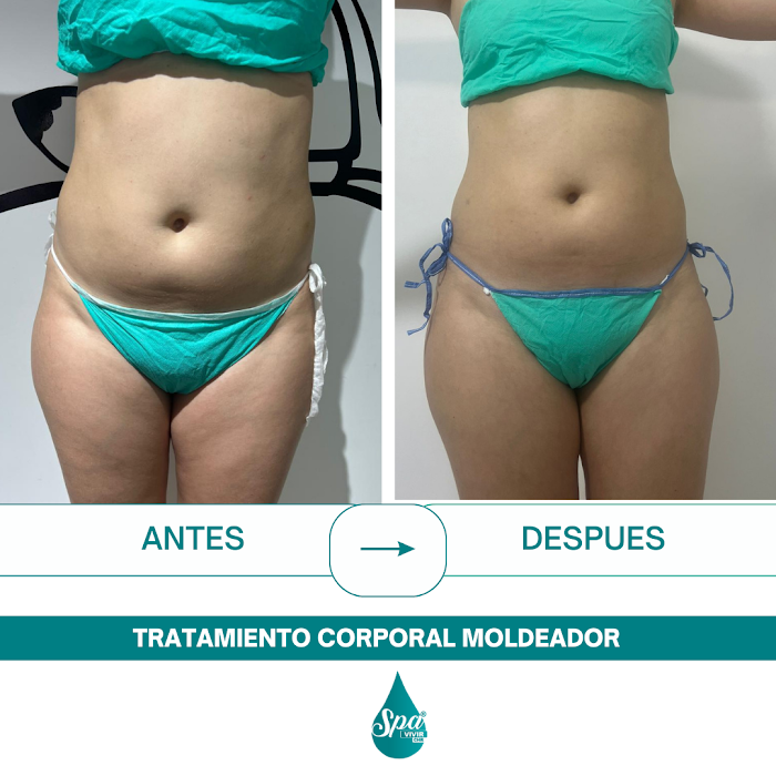 Imagen del Slider