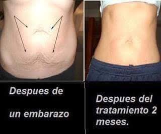 Imagen del Slider