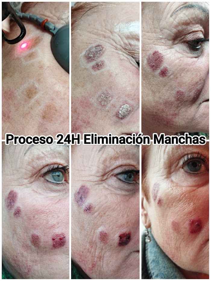 1734185363 854 Microblading cejas ESTETICAS AVANZADA Lana Bernadini Microblading cejas, ESTÉTICAS AVANZADA Lana Bernadini.