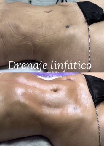 Edy Melo Estética & Bienestar