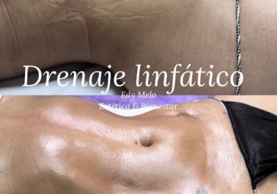 Edy Melo Estética & Bienestar