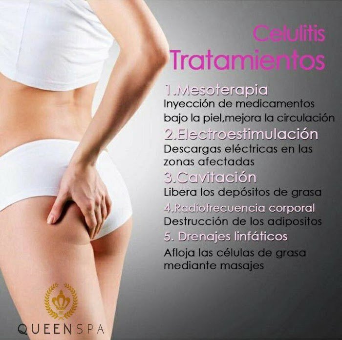 Imagen del Slider