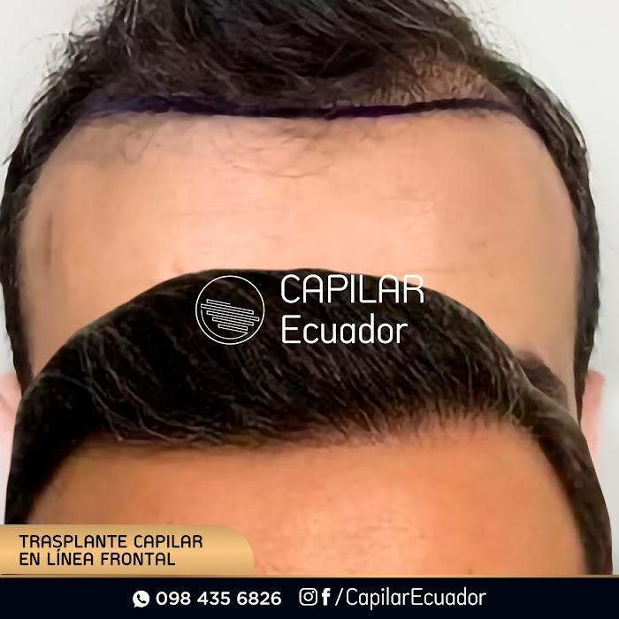 Imagen del Slider