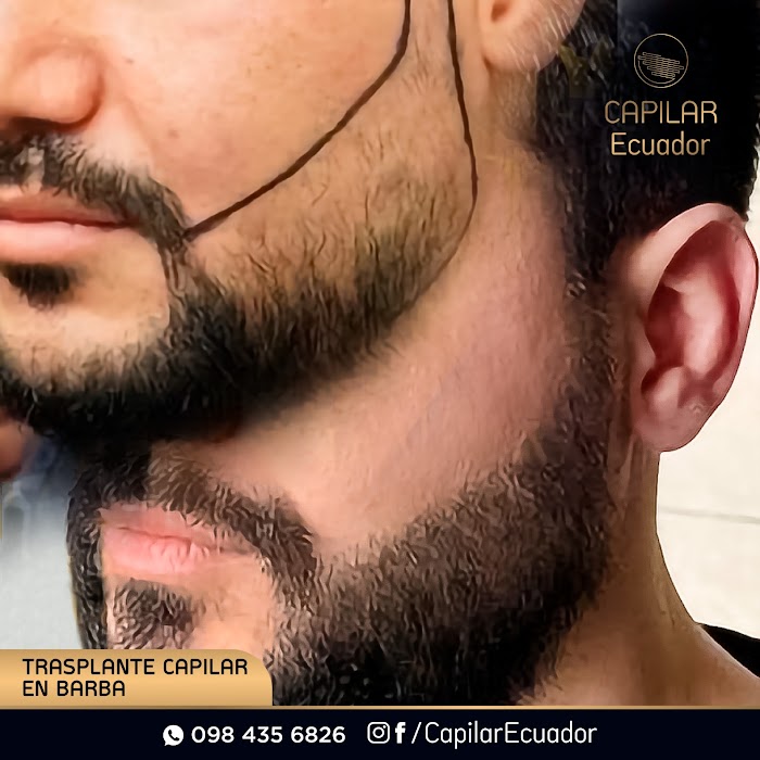 Imagen del Slider