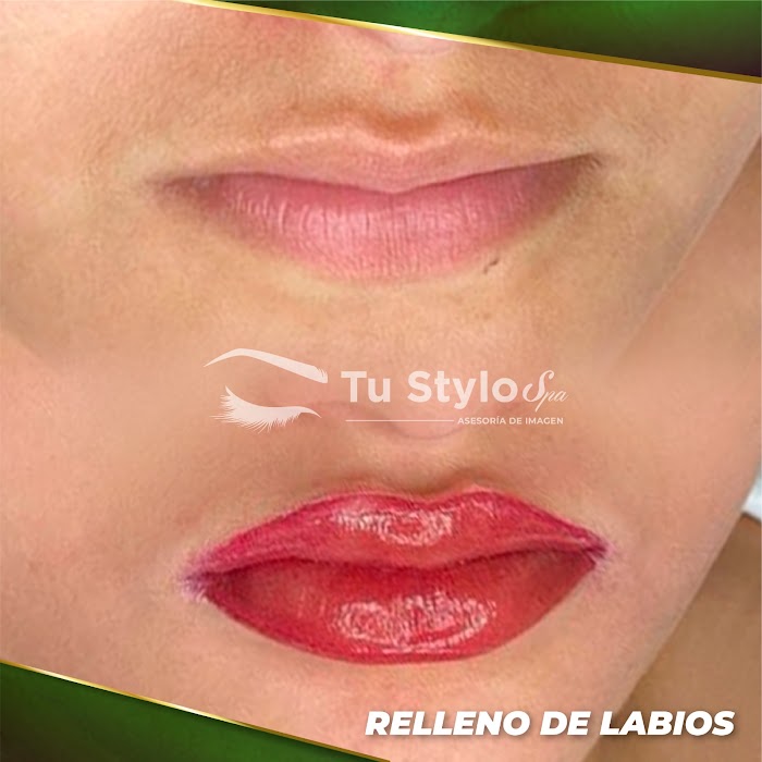 Imagen del Slider