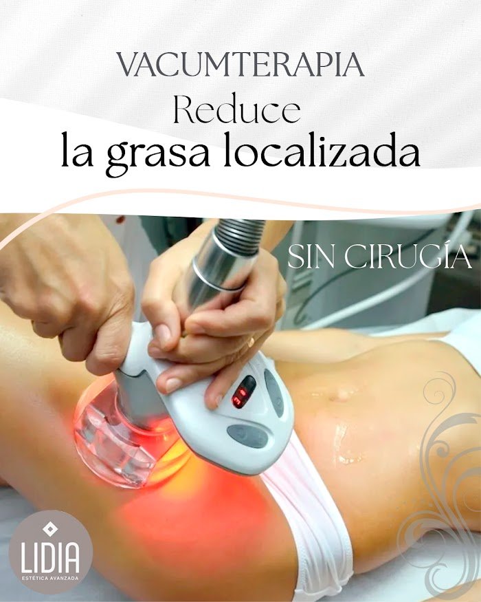 Imagen del Slider