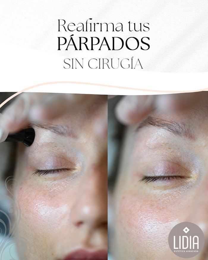 Imagen del Slider