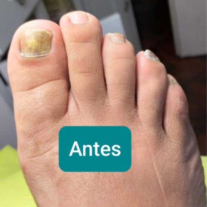 Imagen del Slider